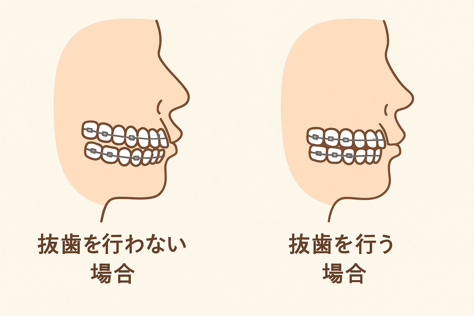 口元の突出感を改善したい場合