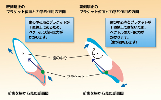 uragawa_catch_faq2